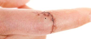 吃洋瓜伤口痒,揭秘洋瓜食用后的奇妙体验